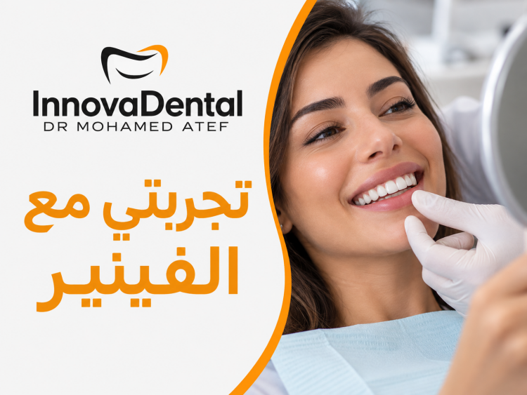 My Honest Dental Veneers Experience: Was the Smile Makeover Worth It?